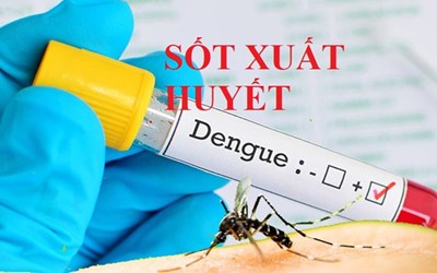 Công tác Y tế và An toàn vệ sinh thực phẩm tháng 4/2025